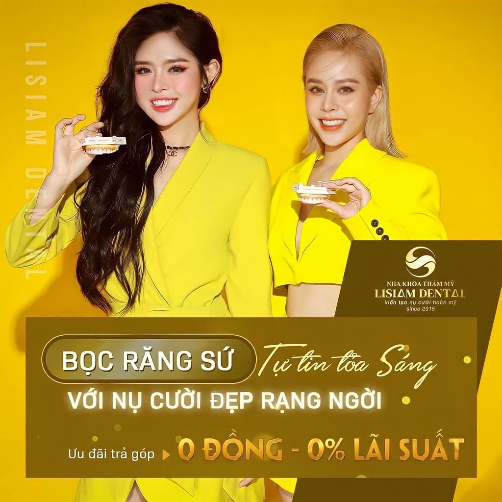 Giải đáp top 5 câu hỏi thường gặp khi bọc răng sứ