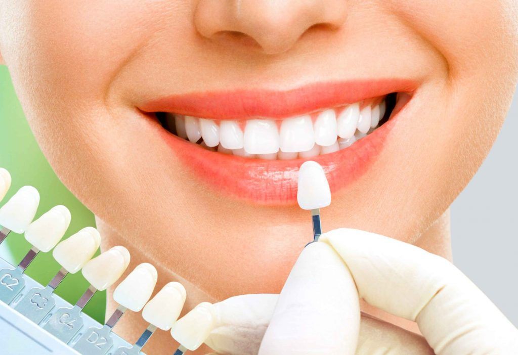 Tìm Hiểu Về Làm Răng Sứ: Giải Pháp Hoàn Hảo Cho Nụ Cười Tự Tin