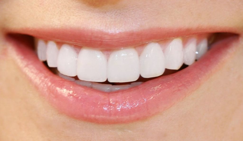 Răng Sứ – Giải Pháp Vừa Đẹp Vừa Khỏe Cho Răng Miệng Của Bạn