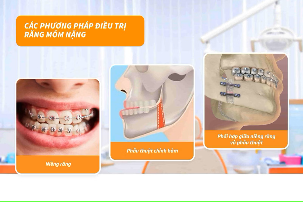 Răng Móm Nên Làm Gì? Tìm Hiểu Các Giải Pháp Hiệu Quả