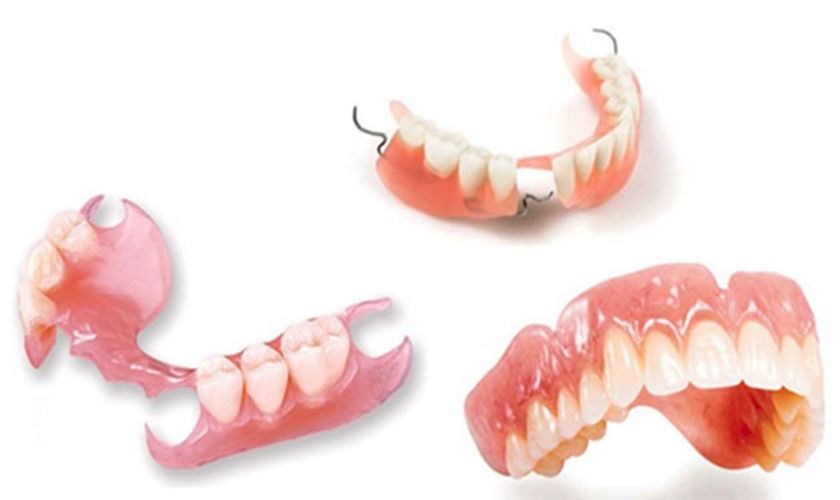 Hàm Giả Tháo Lắp – Giải Pháp Phục Hình Răng Mất Tiết Kiệm