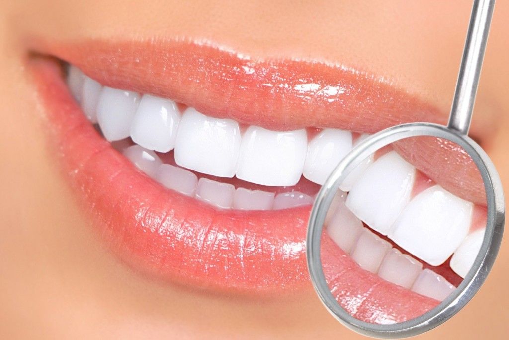 Những Ai Nên Dán Sứ Veneer? Tìm Hiểu Ngay!