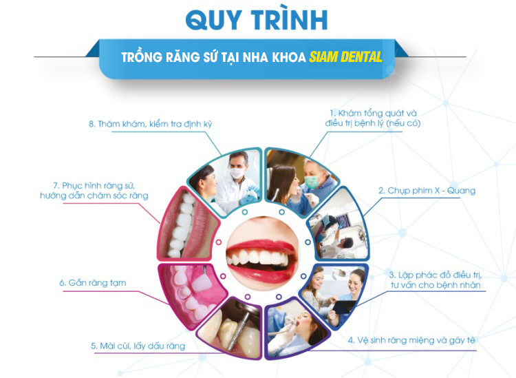 Quy Trình Chế Tạo Răng Sứ Chuẩn Công Nghệ Tại Nha Khoa Siam Dental