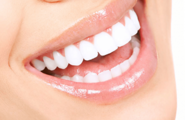 Răng Sứ Có Đủ Cứng Để Thay Thế Răng Thật Không? Giải Đáp Từ Nha Khoa Siam Dental