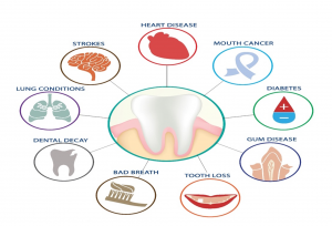 Sức Khỏe Răng Miệng – Chìa Khóa Cho Sức Khỏe Tổng Thể