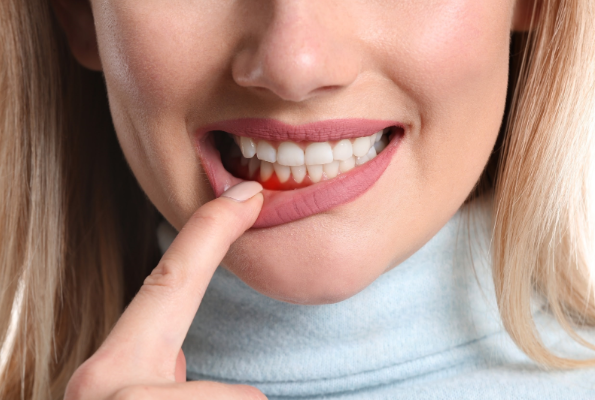Dịch vụ điều trị viêm lợi