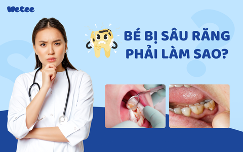 BÉ BỊ SÂU RĂNG PHẢI LÀM SAO?
