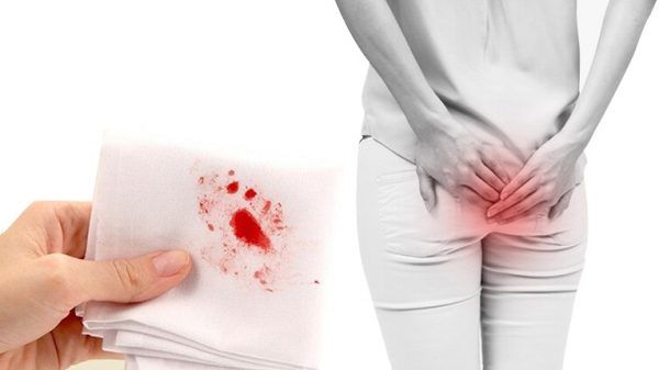 Hình ảnh bài viết