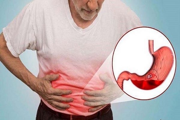 Hình ảnh bài viết