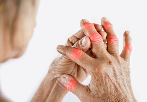 Bệnh gout là gì?