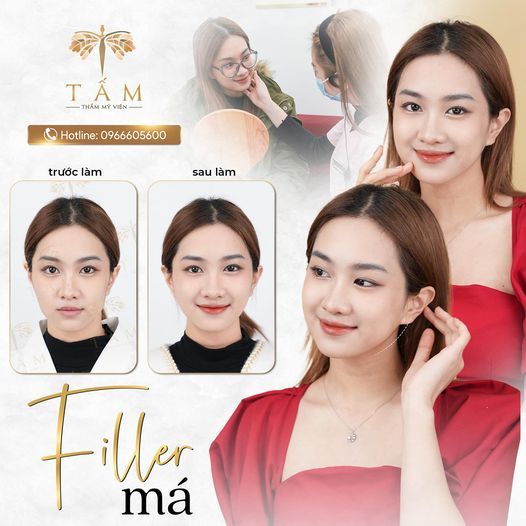 Hình ảnh bài viết