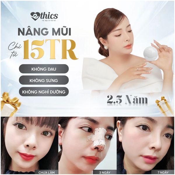 Hình ảnh bài viết