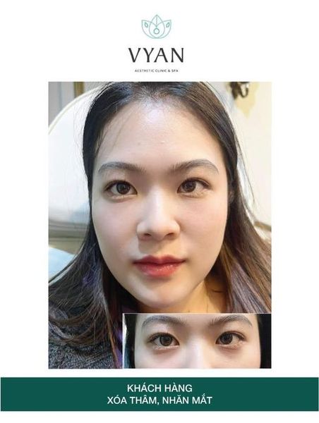Hình ảnh bài viết