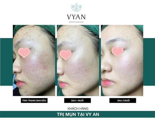 Hình ảnh bài viết