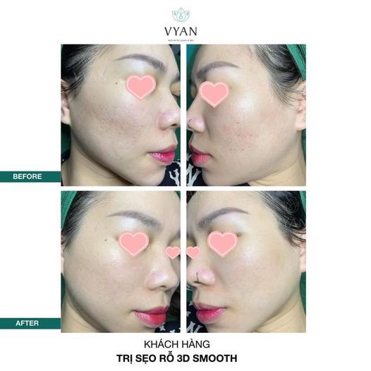 Hình ảnh bài viết