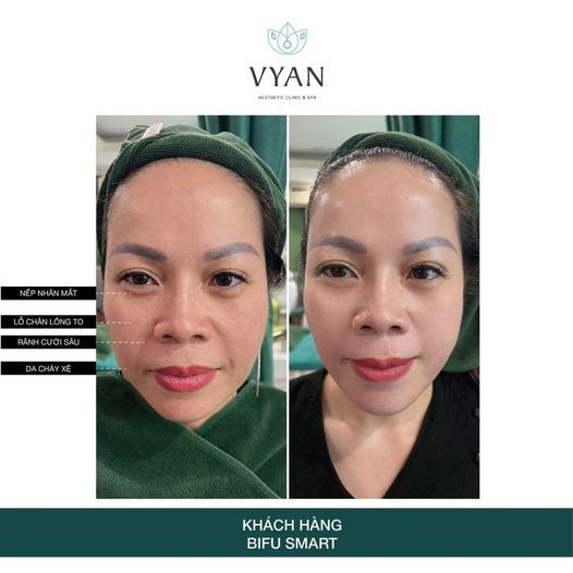 Hình ảnh bài viết