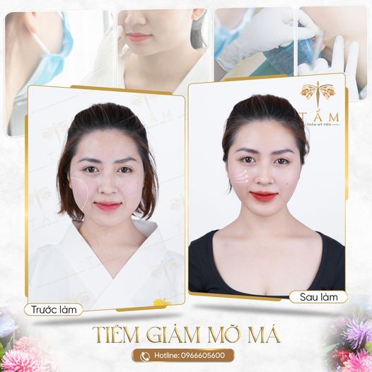 Hình ảnh bài viết