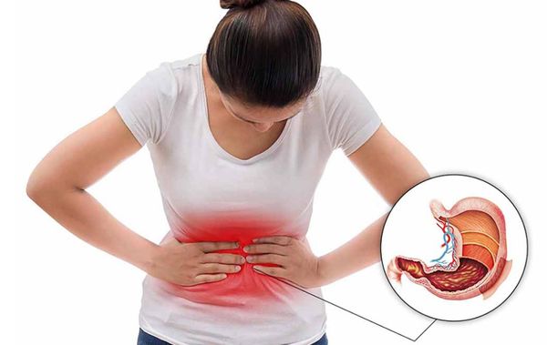 Hình ảnh bài viết