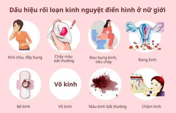 Hình ảnh bài viết