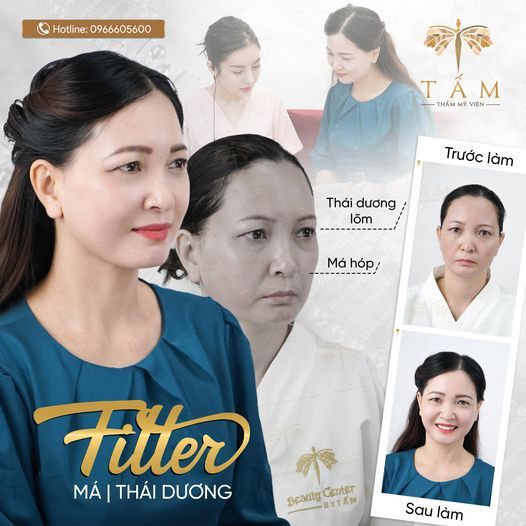 Hình ảnh bài viết