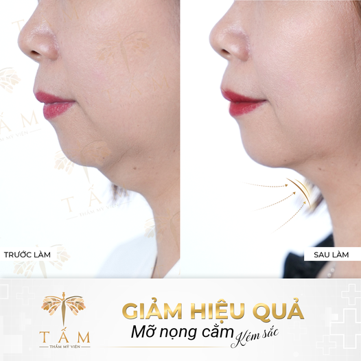 Hình ảnh bài viết