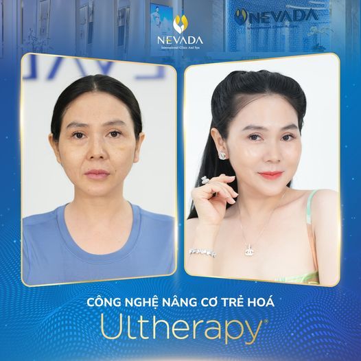 Hình ảnh bài viết