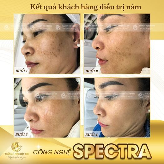 Hình ảnh bài viết