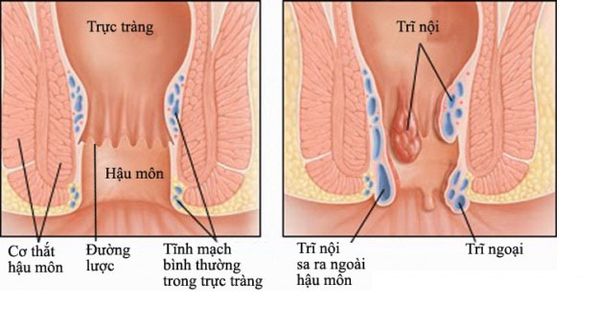 Hình ảnh bài viết
