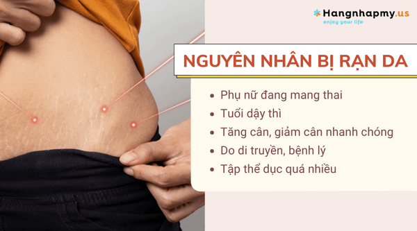 Hình ảnh bài viết