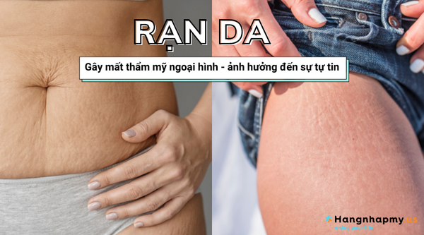 Hình ảnh bài viết