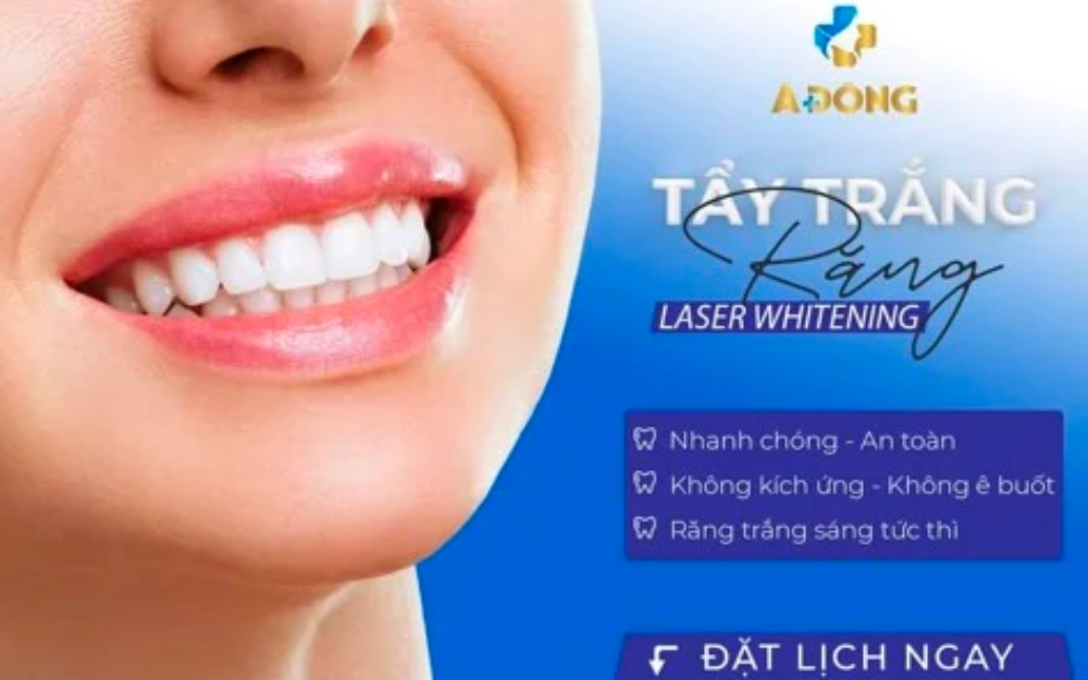 Tẩy Trắng Răng Laser Whitening