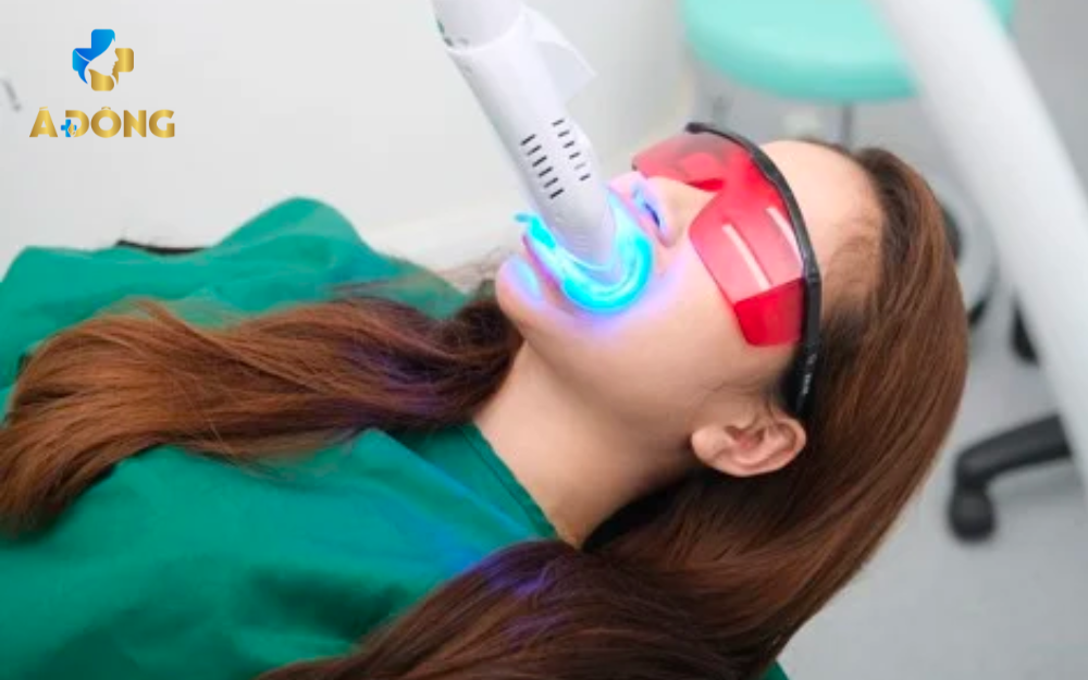 Tẩy Trắng Răng Với Công Nghệ White Smile