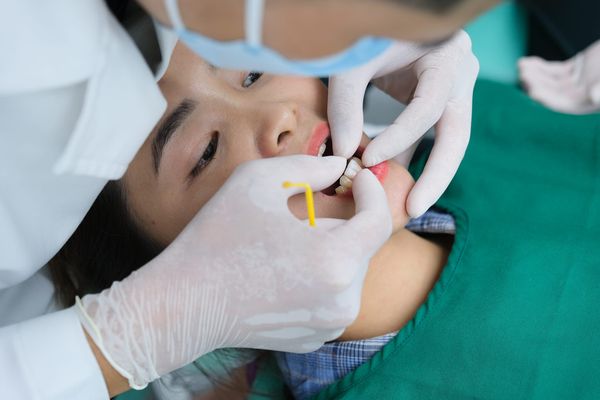 Bọc răng sứ - Nha khoa Á Đông