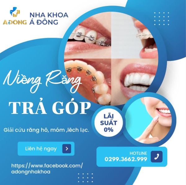 Niềng răng trả góp 0% - Nha khoa Á Đông