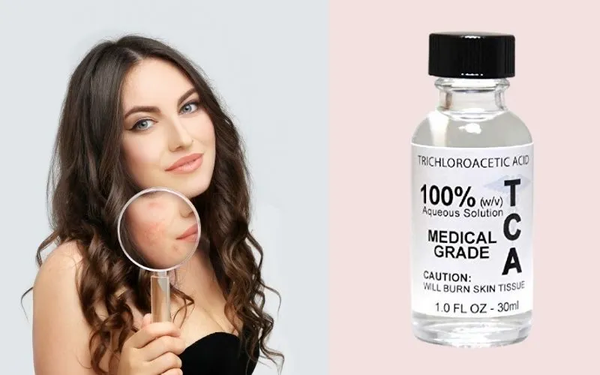 Có nên peel da không