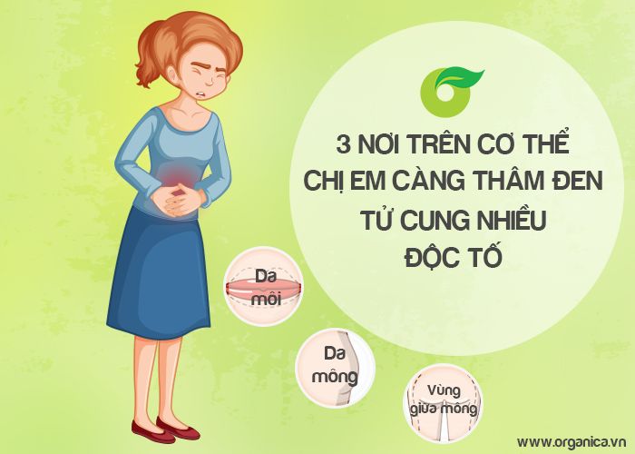 3 nơi trên cơ thể chị em càng thâm đen, tử cung nhiều độc tố