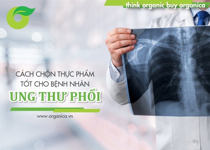 Cách chọn thực phẩm tốt cho bệnh nhân ung thư phổi