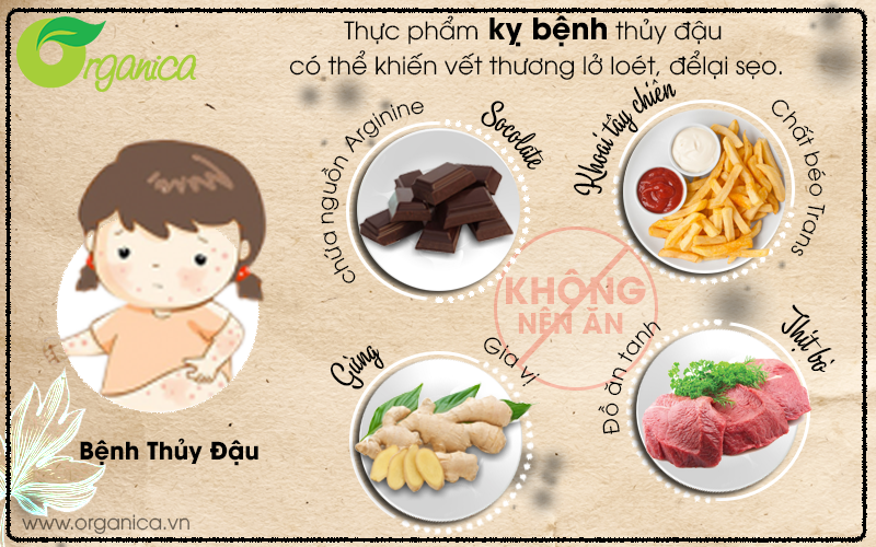 9 thực phẩm kỵ bệnh thủy đậu có thể khiến vết thương lở loét, để lại sẹo.