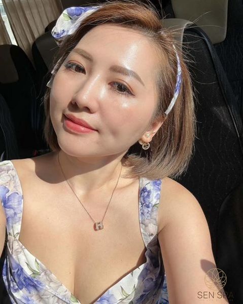 Làm trắng da bằng tiêm meso