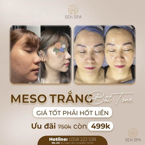 Tiêm meso trắng da