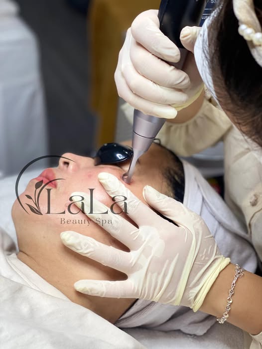 Content chăm sóc da - Laser