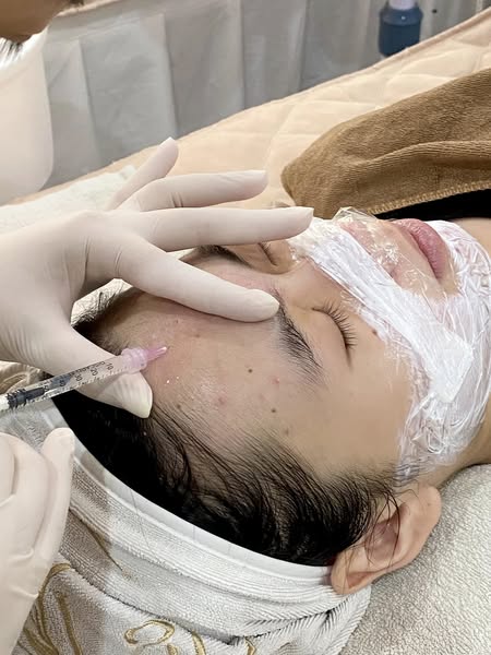 Content chăm sóc da - Meso ASCE