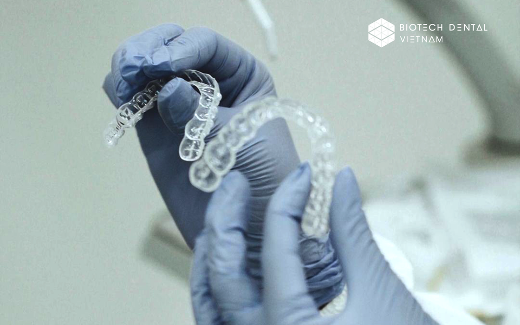 Công nghệ Scan 3D và AI trong Smilers: Cách mạng hóa điều trị chỉnh nha
