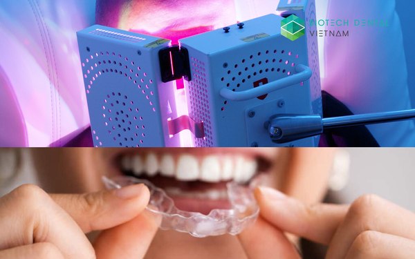 Tăng tốc độ niềng răng trong suốt với liệu pháp điều chế quang sinh học từ thiết bị ATP38