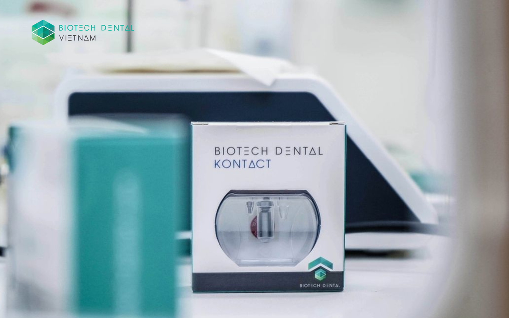 IMPLANT KONTACT LÀ GÌ? TẤT TẦN TẬT THÔNG TIN VỀ TRỤ IMPLANT HÀNG ĐẦU TỪ PHÁP