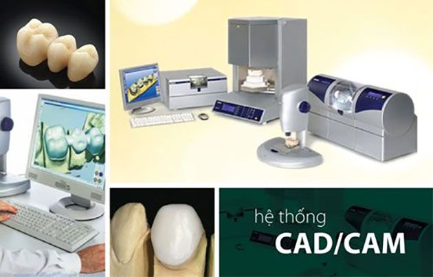 Răng sứ CAD/CAM  là gì ?