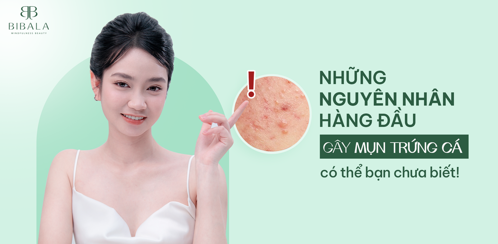 NHỮNG NGUYÊN NHÂN HÀNG ĐẦU GÂY MỤN TRỨNG CÁ CÓ THỂ BẠN CHƯA BIẾT