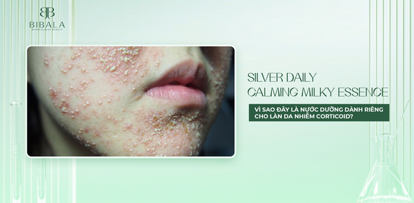 Silver Daily Calming Milky Essence - Vì sao đây là nước dưỡng dành riêng cho làn da nhiễm corticoid?