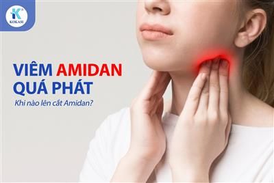 VIÊM AMIDAN QUÁ PHÁT VÀ LƯU Ý VỀ BỆNH