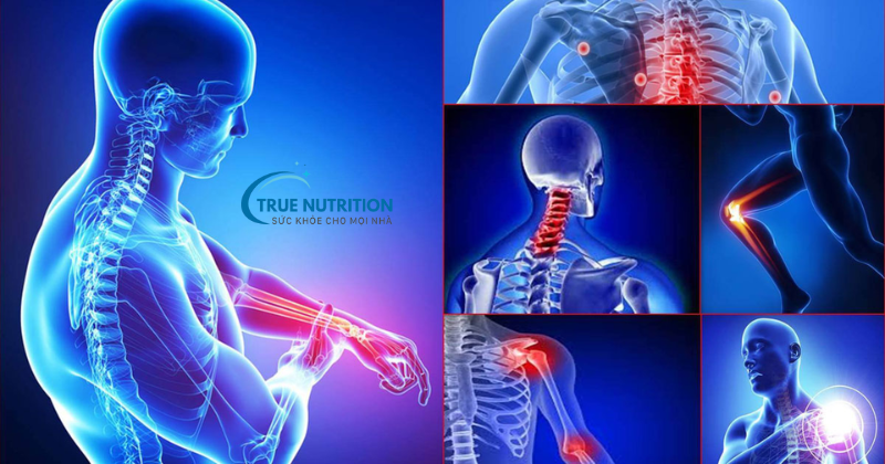 Bệnh viêm khớp, thoái hóa khớp và đau thắt lưng ở người lao động